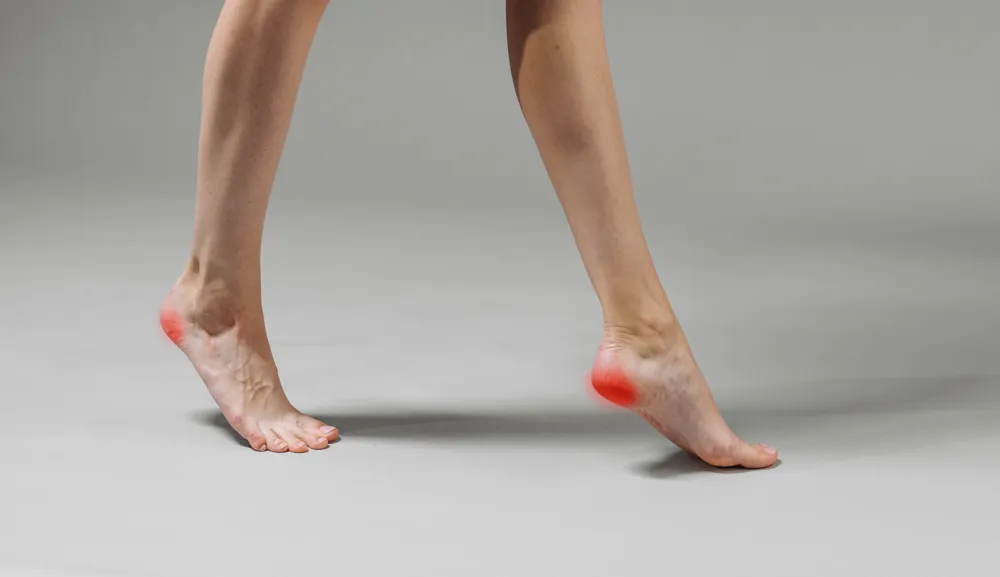 hälsporre behandling