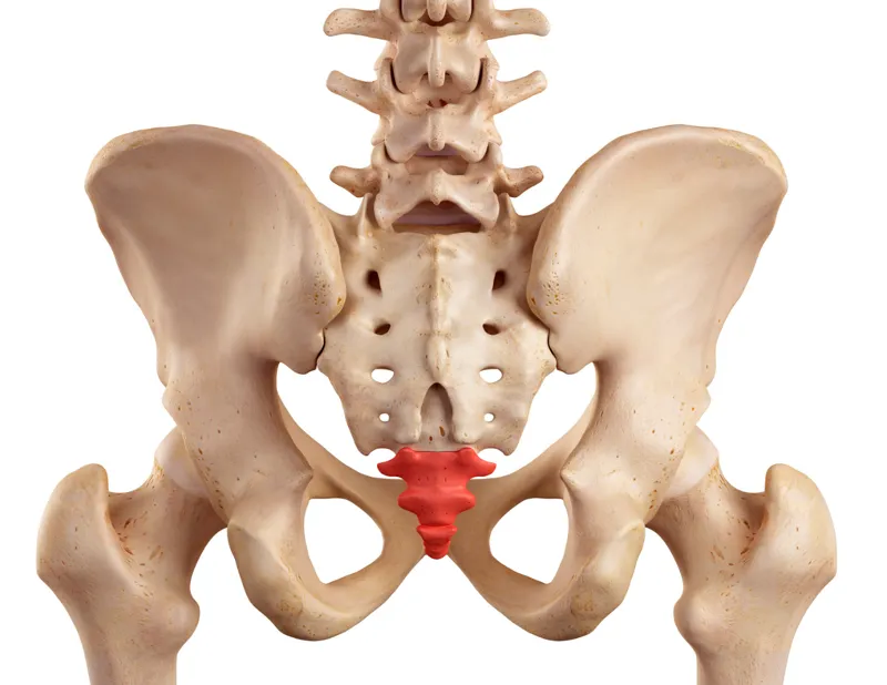 Typiska symtom vid coccygodyni